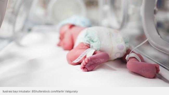 parameter-alat-keliru-dapat-berakibat-fatal-kasus-bayi-meninggal-di-incubator-20160909-07-48-0698.jpg